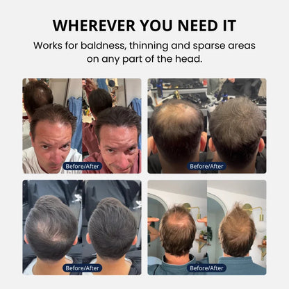 🔥Buy 1 Get 1 Free🔥Hair Density Cream