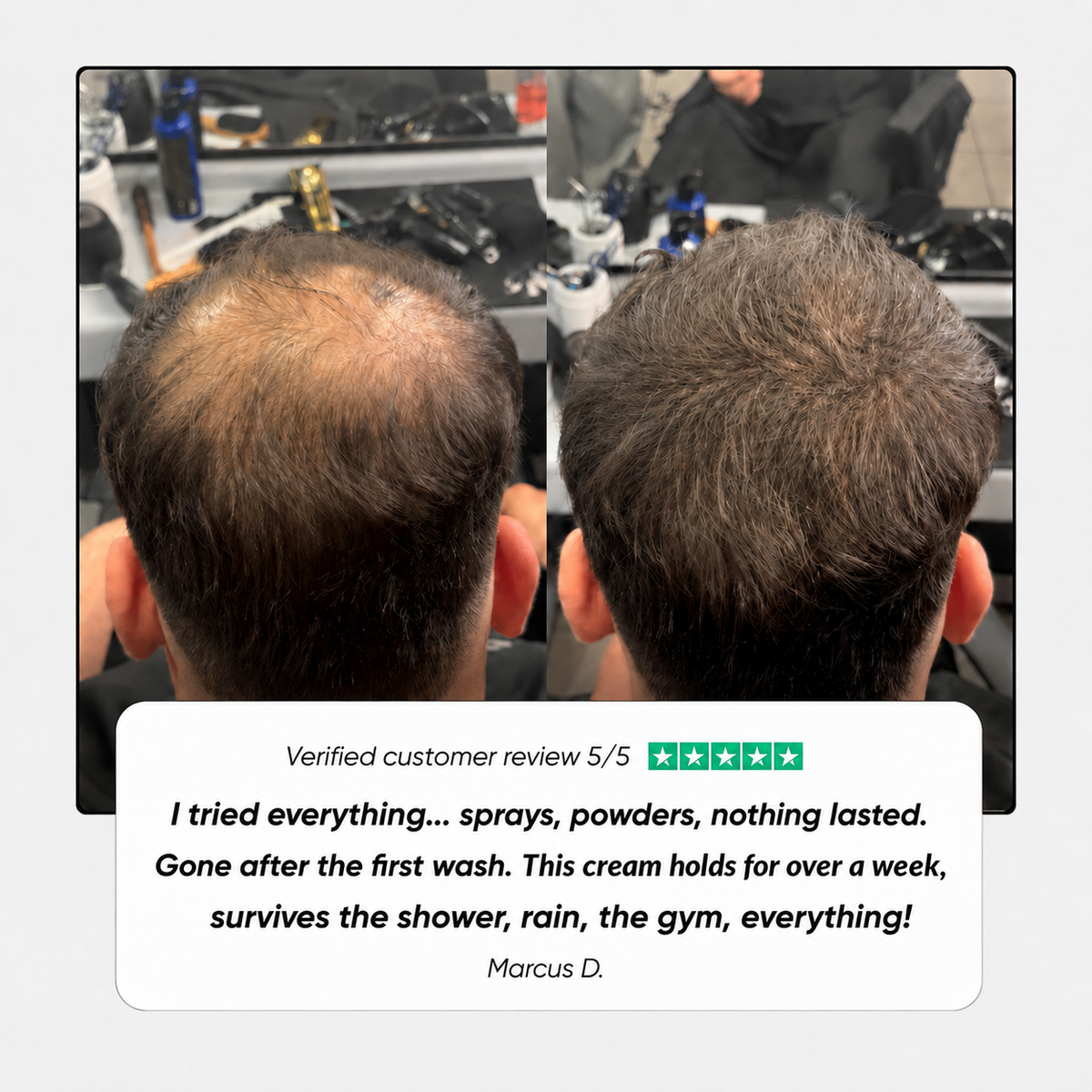 🔥Last Day 50% OFF⏰Hair Density Cream