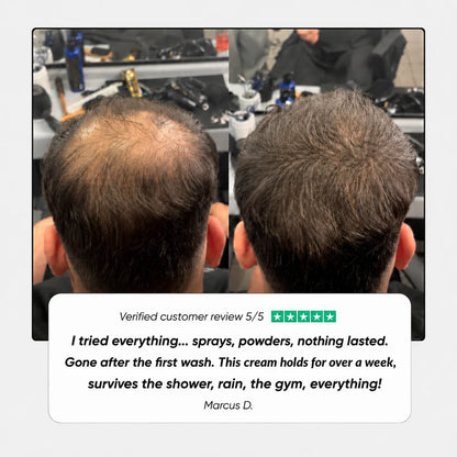 🔥Buy 1 Get 1 Free🔥Hair Density Cream